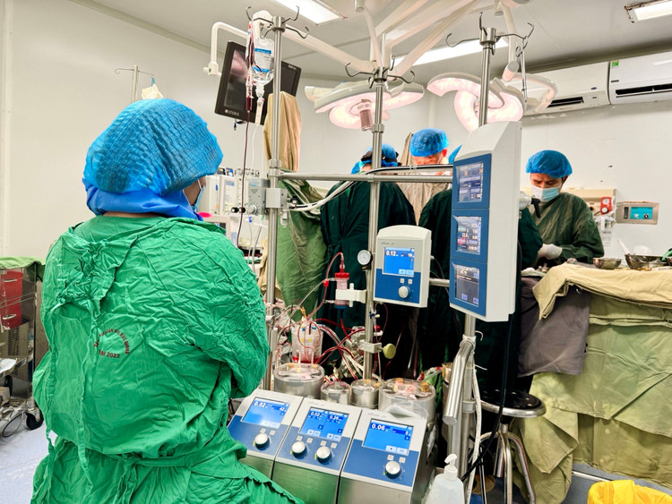 Hệ thống máy tuần hoàn chạy tim phổi nhân tạo ngoài cơ thể được thiết lập trong phẫu thuật - Ảnh BVCC Hệ thống máy tuần hoàn chạy tim phổi nhân tạo ngoài cơ thể được thiết lập trong phẫu thuật - Ảnh BVCC