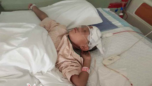 Đột quỵ não ở trẻ - Ảnh minh họa