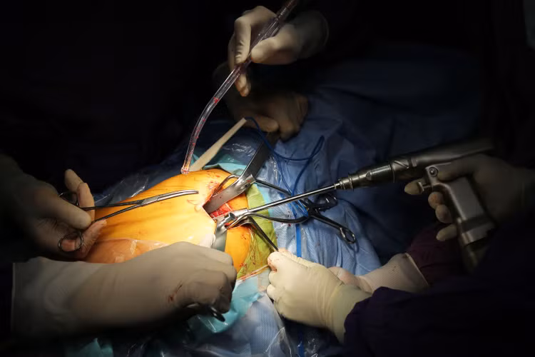 Công nghệ thay khớp háng nhân tạo tiên tiến không cắt gân cơ ảnh 2