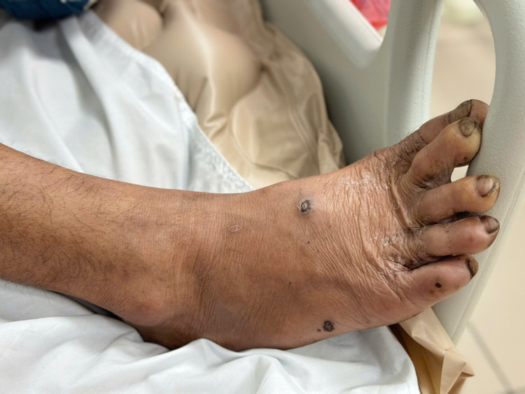 Vết thương nhỏ hậu quả lớn- Ảnh BVCC