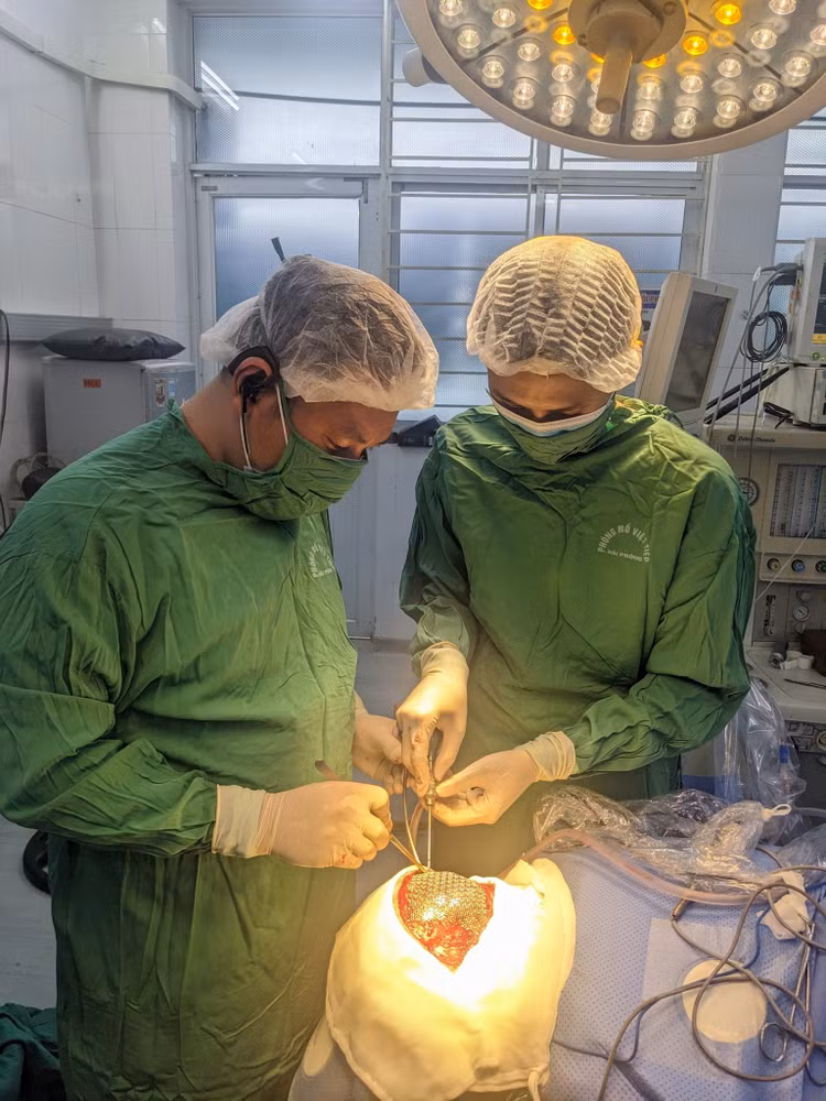 Bác sĩ Khoa Phẫu thuật Sọ não cột sống tạo hình lại ổ khuyết sọ của người bệnh bằng lưới titanlium