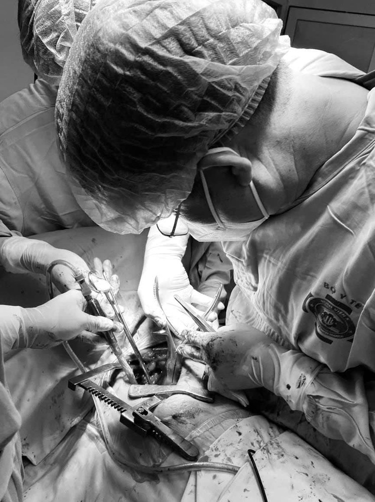 Ca mổ nhiều thách thức được ê-kíp phẫu thuật cẩn trọng tỉ mỉ - Ảnh BVCC