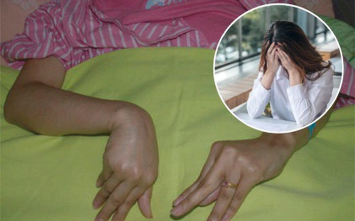 Co thắt bàn chân, bàn tay đột ngột... là một trong những dấu hiệu hạ canxi máu