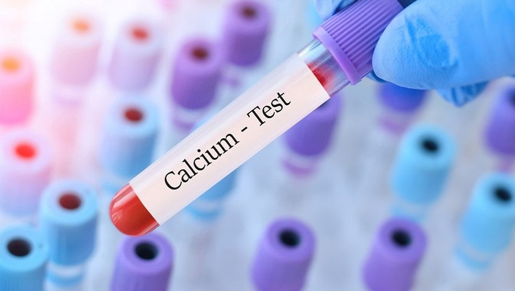 Cách tránh Hạ canxi máu sẽ gây ra nhiều vấn đề sức khỏe nguy hiểm