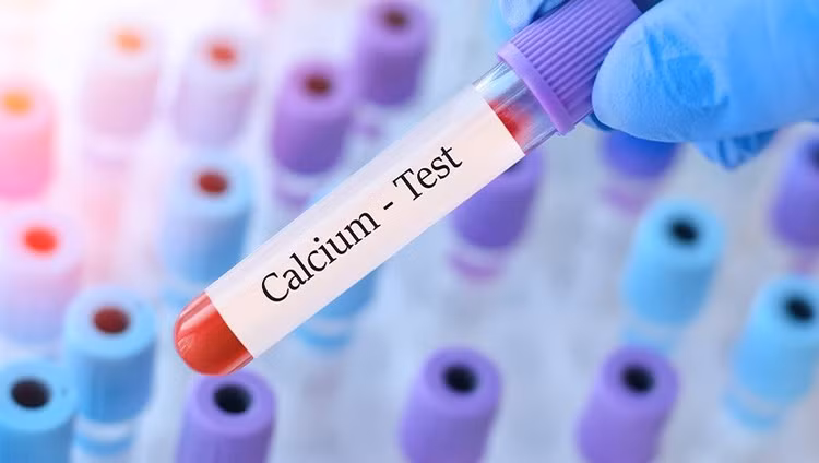 Cách tránh Hạ canxi máu sẽ gây ra nhiều vấn đề sức khỏe nguy hiểm
