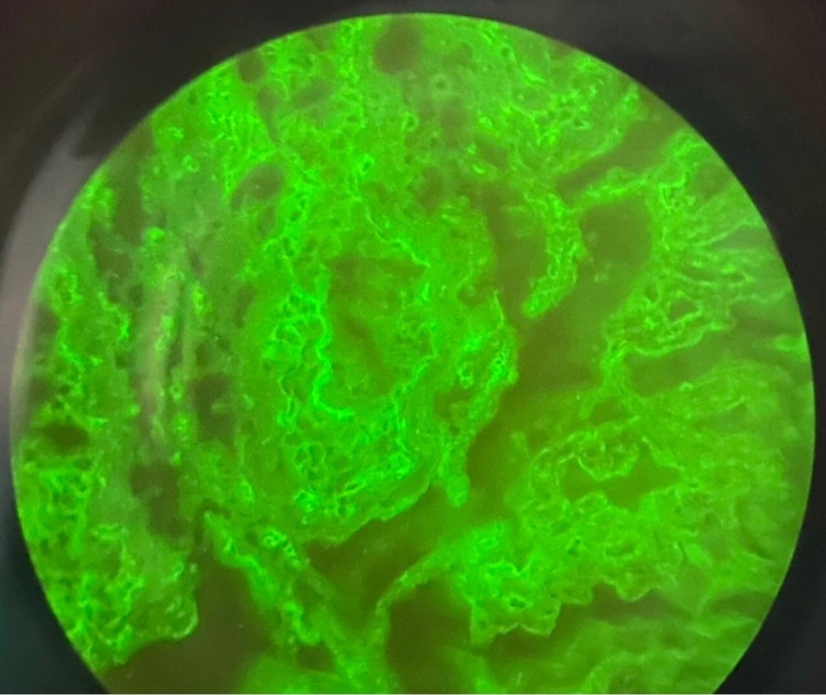 Kết quả miễn dịch huỳnh quang gián tiếp trên bàng quang chuột: IgG dương tính ở khoảng gian bào và màng đáy