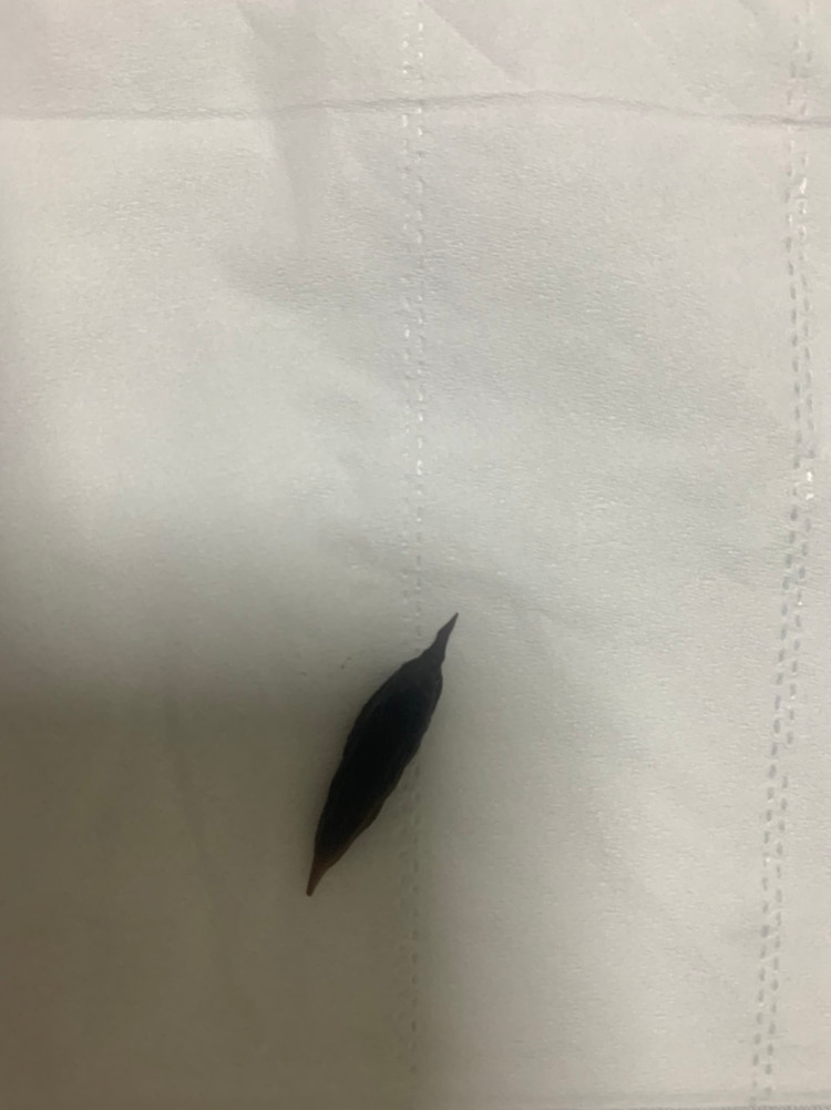 Hạt táo được lấy ra - Ảnh BVCC