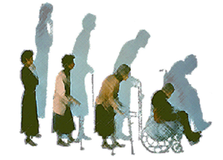 Loãng xương dẫn đến nguy cơ gẫy xương ở người già - Ảnh minh họa