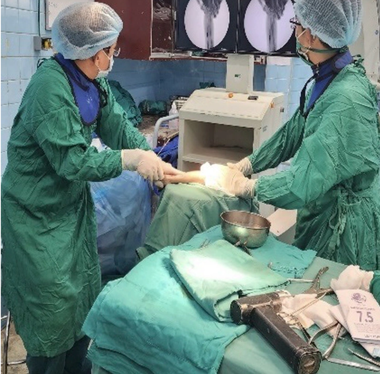 Ca phẫu thuật cánh tay đứt lìa cho bệnh nhi - Ảnh BVCC