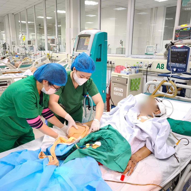 Hồi sức tích cực cho bệnh nhân - Ảnh BVCC