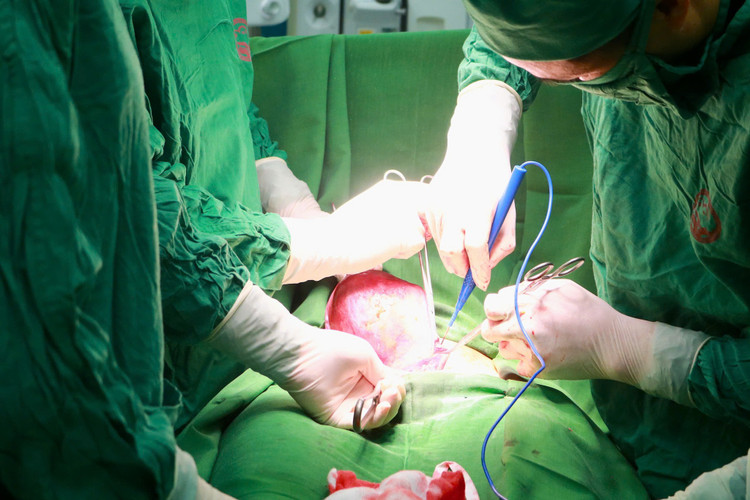Ca phẫu thuật cho bệnh nhân - ảnh BVCC Ca phẫu thuật cho bệnh nhân - ảnh BVCC