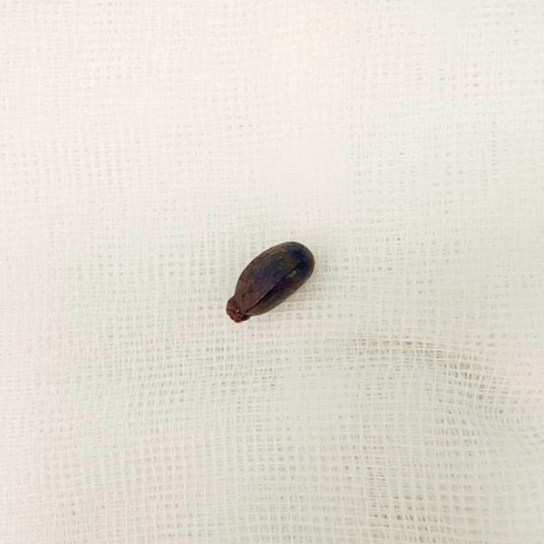 Hạt mãng cầu được lấy ra - Ảnh BVCC