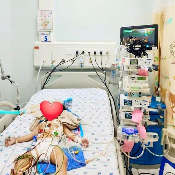 Trẻ bị hóc hạt mãng cầu được hồi sức tích cực - Ảnh BVCC