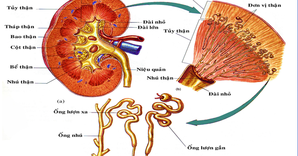 Tăng axit uric gây viêm ống thận kẽ ở người trẻ