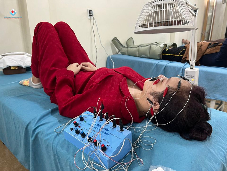 Châm cứu chữa liệt mặt tại bệnh viện đa khoa Hùng Vương