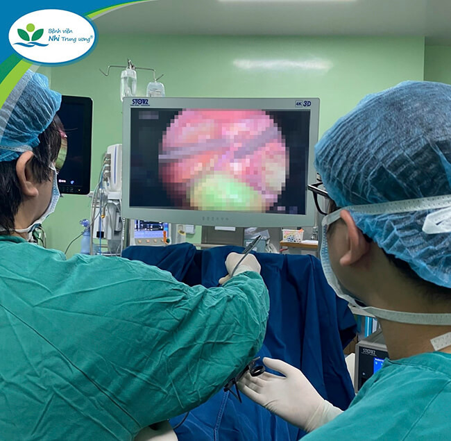 Sự kết hợp giữa chuyên môn vững vàng, kinh nghiệm dày dạn và hệ thống phẫu thuật nội soi tiên tiến, sẽ giúp các bệnh nhi có được hiệu quả phẫu thuật tốt nhất