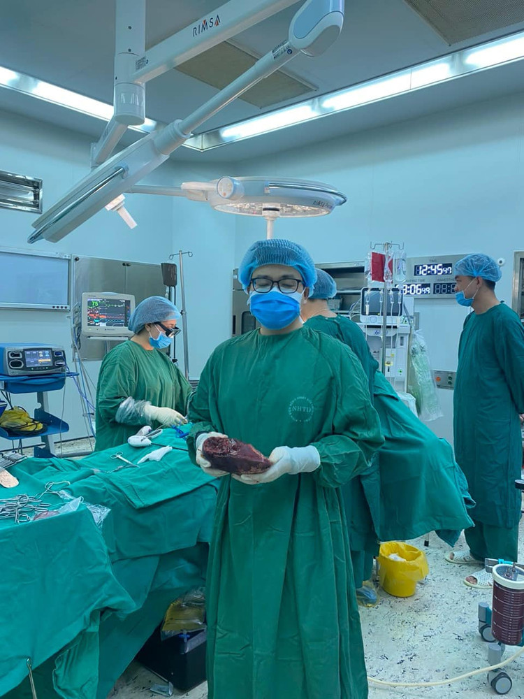 Khối u gan được lấy ra - Ảnh BVCC