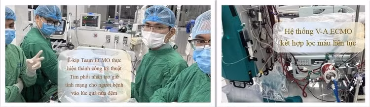 ecmo2-716ea427cfdb43d8adb00d53d22eaad8-1024x1024.jpg