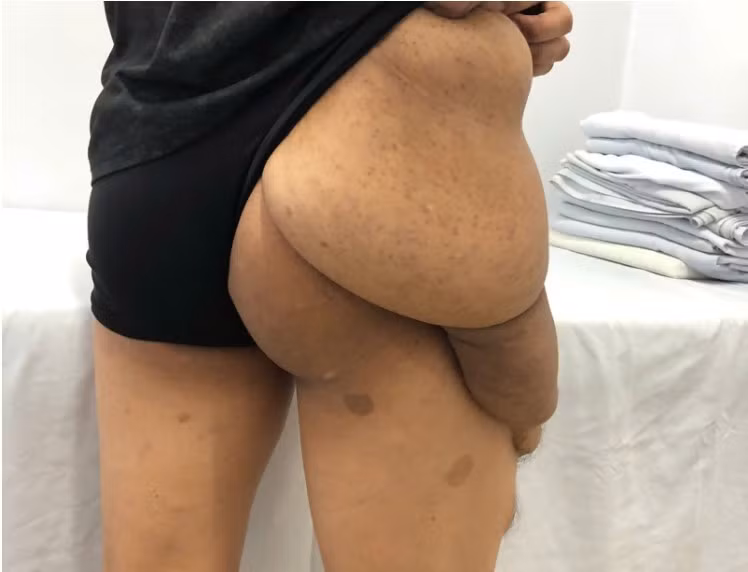 u-than-kinh-1.jpg