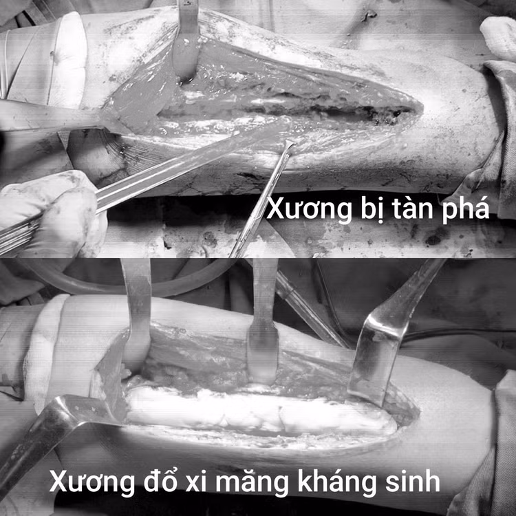 xuong-dui-2.jpg