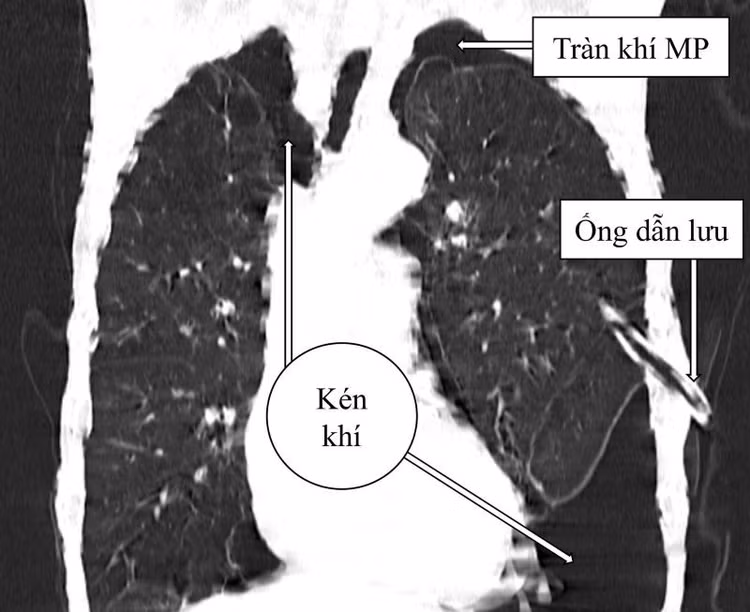 ken-pphoi.jpg