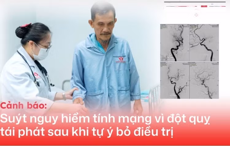 2-lan-dot-quy-9114.jpg