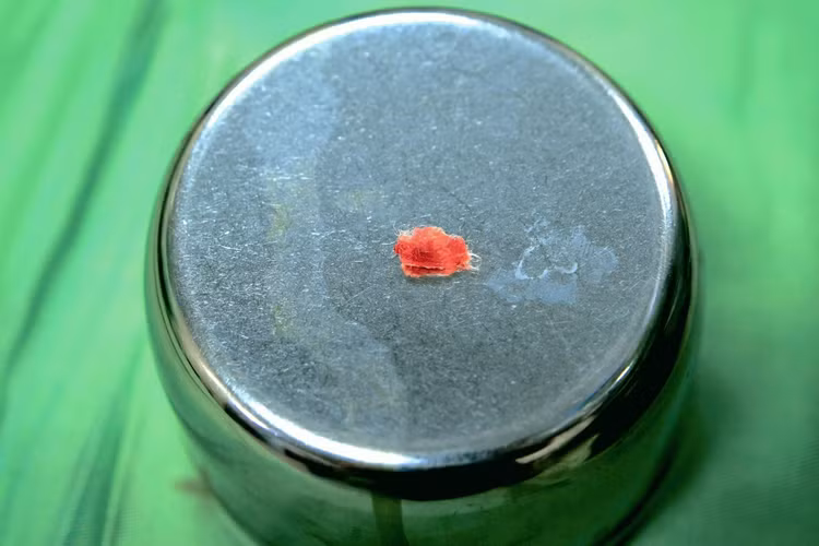 di-vat-am-dao-3.jpg