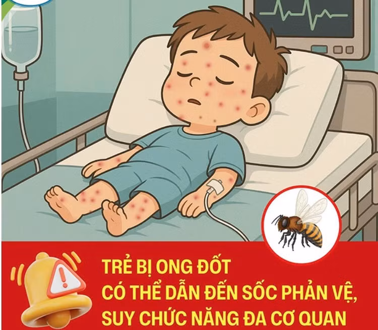 soc-ong.jpg