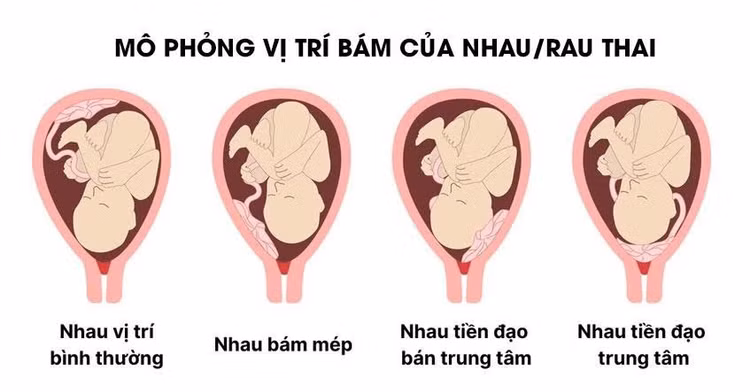 rau-tien-dao-2.jpg