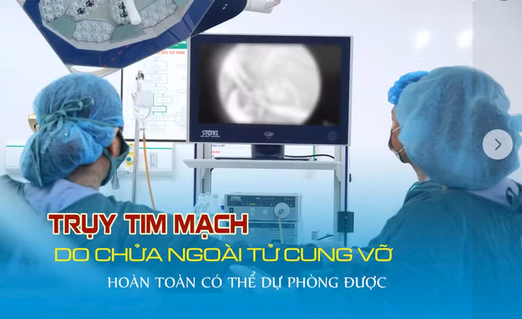 chua-ngoai-tu-cung.png