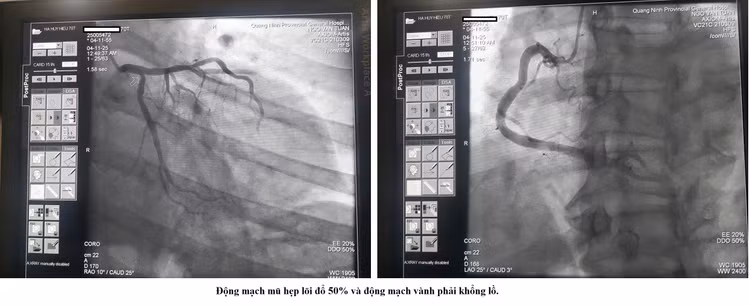 hep-khit-1.jpg