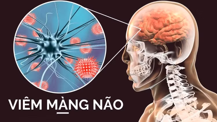 viem-mang-nao-mo-cau.jpg