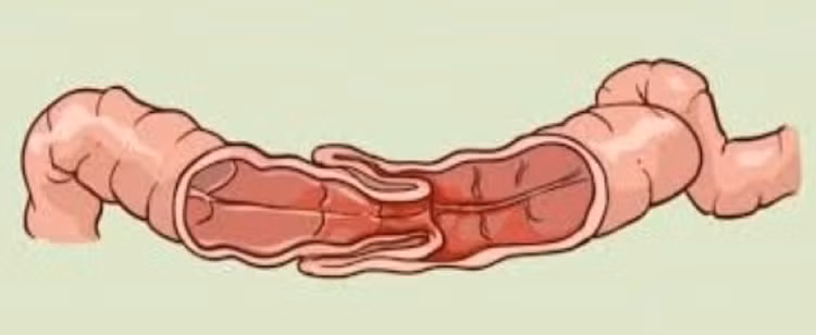long-ruot-1.jpg