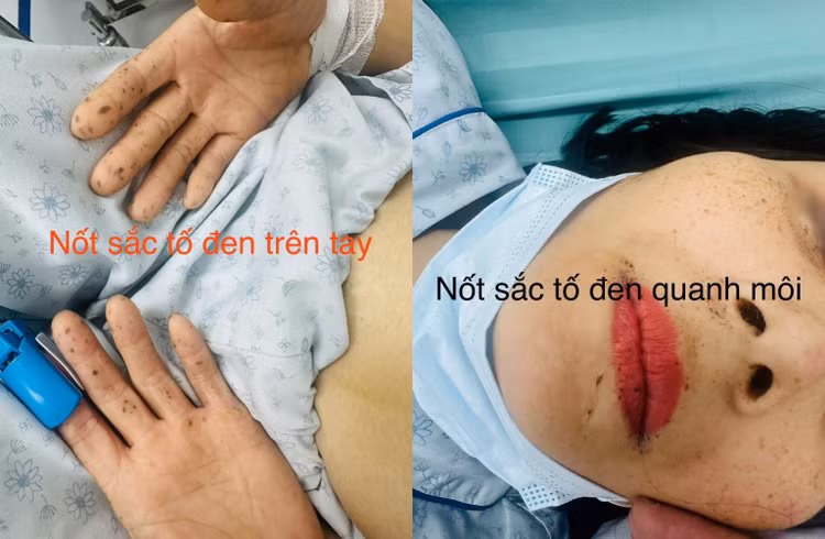 tac-ruot-non-1.jpg