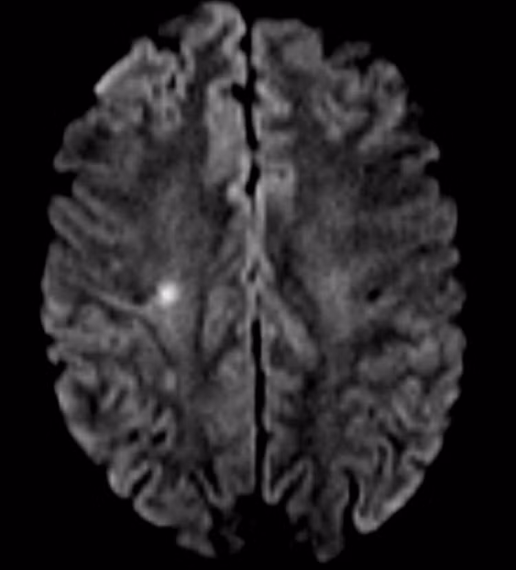 du-khach-my-1hinh-ton-thuong-nao-tren-phim-mri-2-768x848.jpg