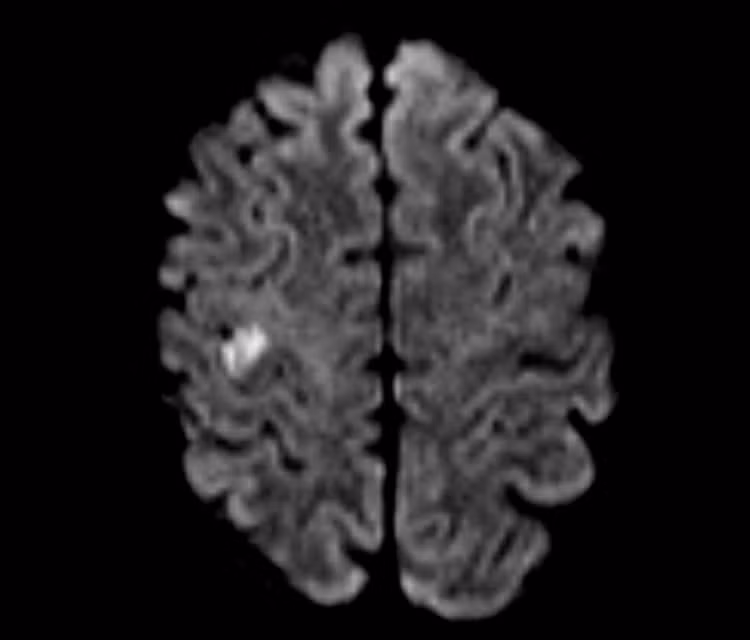 du-khach-my-hinh-ton-thuong-nao-tren-phim-mri-1-768x655.jpg