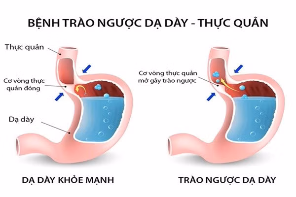 trao-nguoc.jpg
