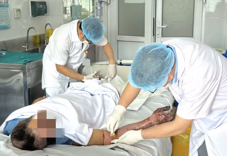 bong-dien-1.jpg