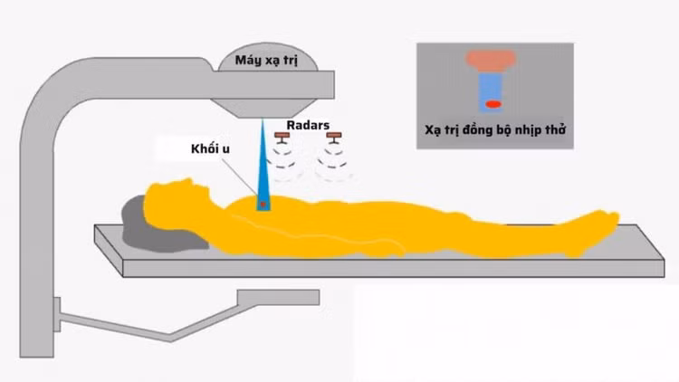 xa-tri-dong-bo-nhip-tho.jpg