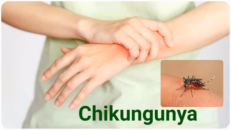 chiku.jpg