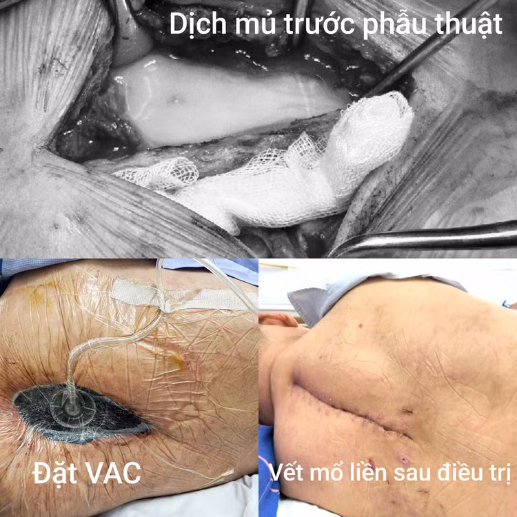 nhiem-nam-4.jpg