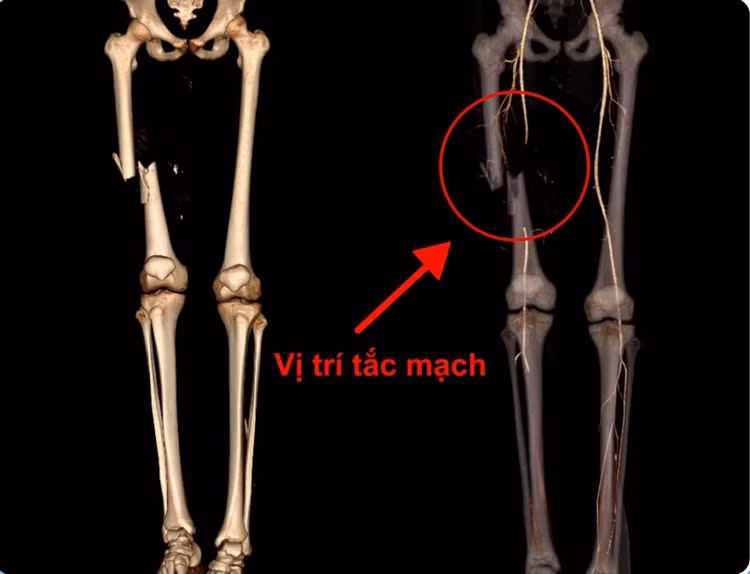 tac-mach-chi-2.png