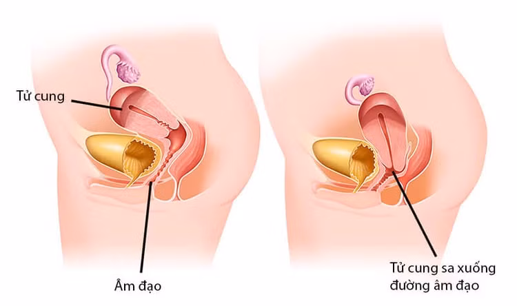 sa-sinh-duc.jpg