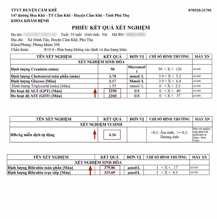 viem-gan-b-nh3-6896.jpg