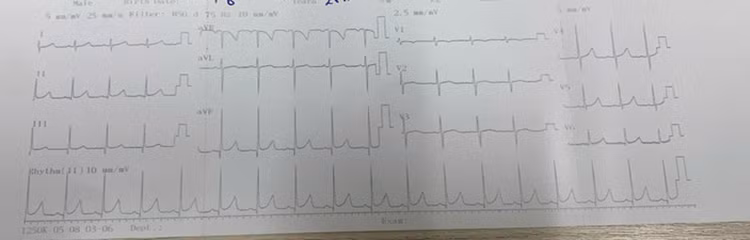 nhip-nhanh-1.jpg