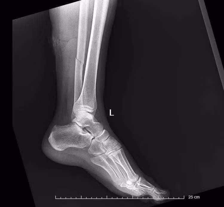 vet-thuong-2.jpg