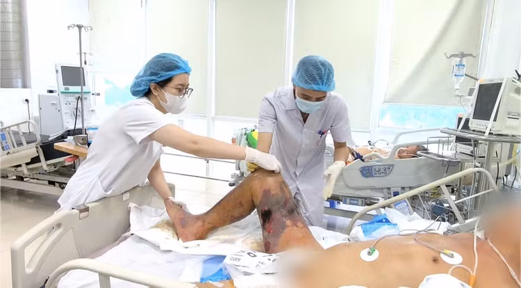 vet-xuoc-nho-1.jpg