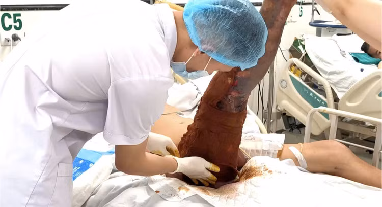 vet-xuoc-nho-3.jpg