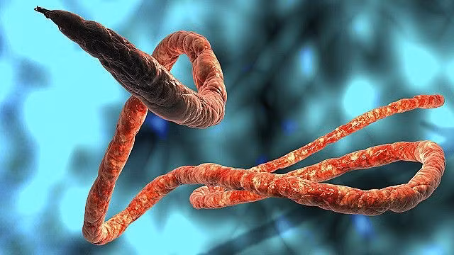 ebola-5557.jpg