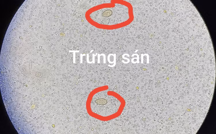 san-la-gan.jpg